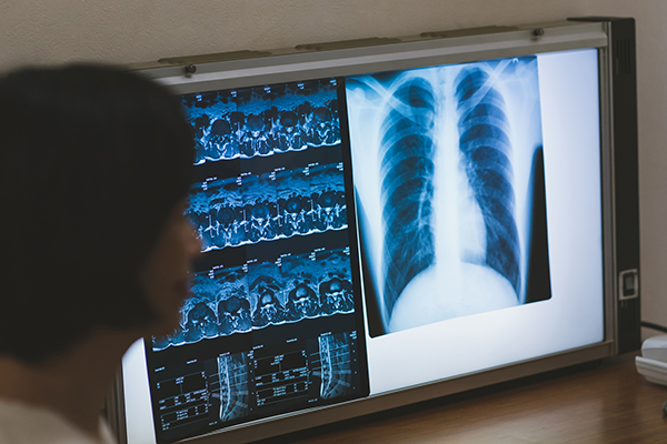 �����g�Q���ʐ^